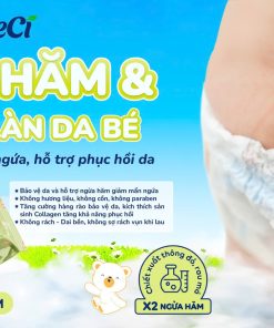 Khăn ướt ngừa hăm tã